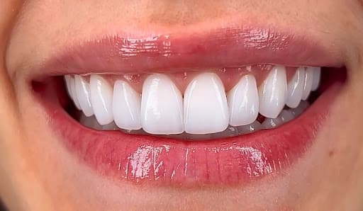 Clinica Dental Benalúa logo