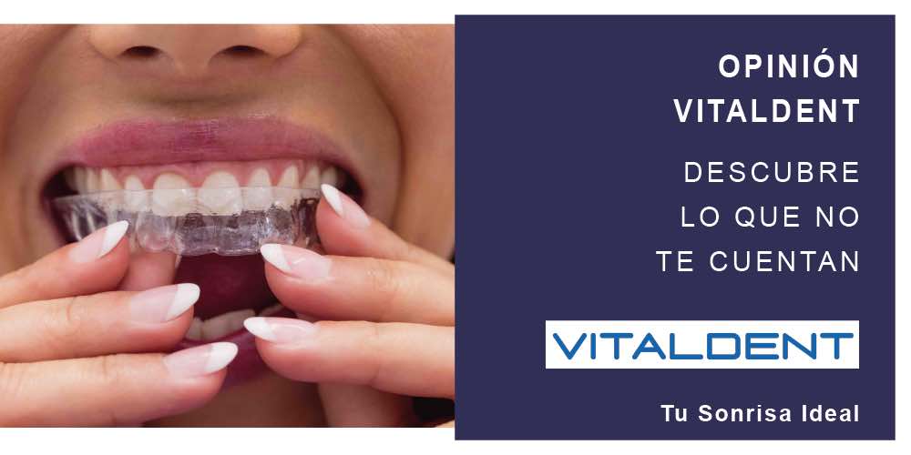 opinion vitaldent 3