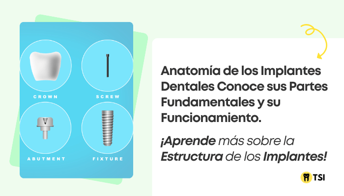 anatomia de los implantes dentales conoce sus partes 2