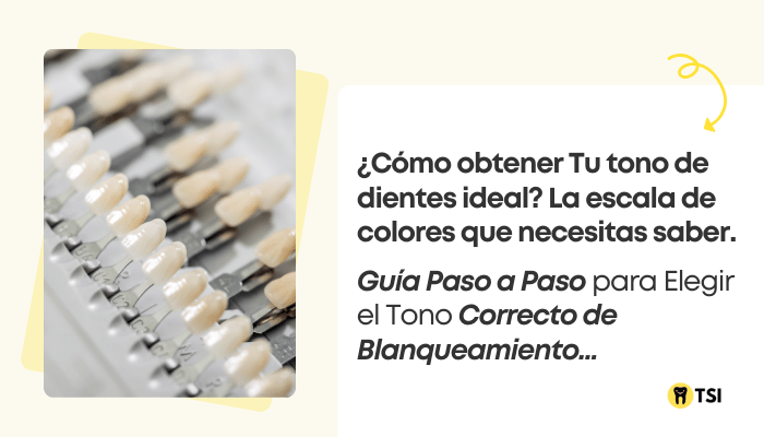 como obtener tu tono de dientes ideal 1