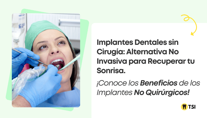 Implantes dentales sin cirugía: Guía completa con todo lo que debes saber