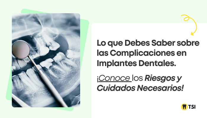 Complicaciones de los Implantes Dentales. Qué causas, previsiones y mejores soluciones existen
