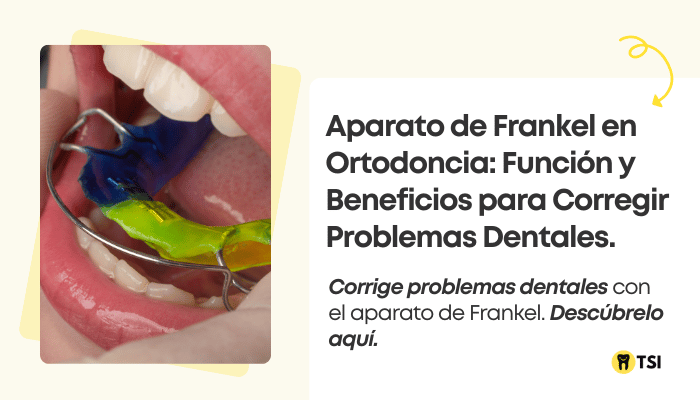 aparato de frankel en ortodoncia funcion y beneficios para corregir problemas dentales 1