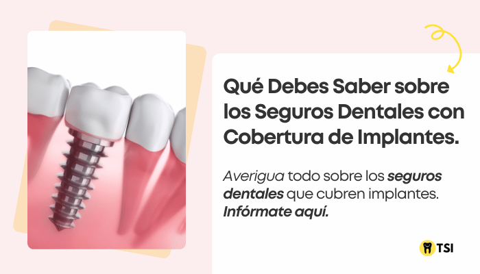 Seguro dental que cubra implantes: la mejor opción para ti 2024