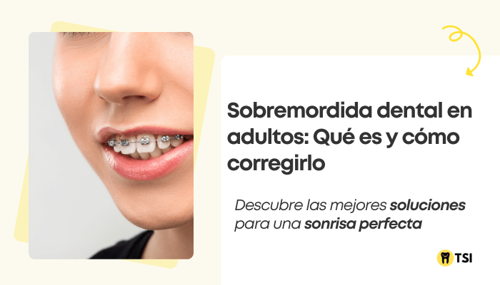 sobremordida en adultos como solucionarlo 2