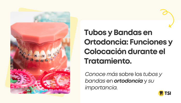 tubos y bandas en ortodoncia funciones y conocacion durante el tatamiento 1