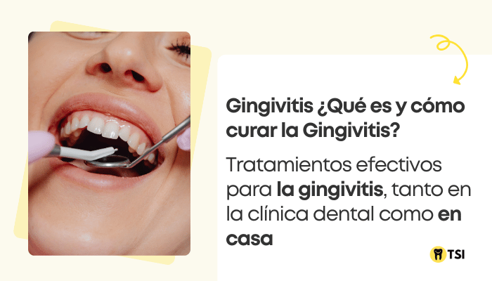 Que es y como curar la Gingivitis 1 1